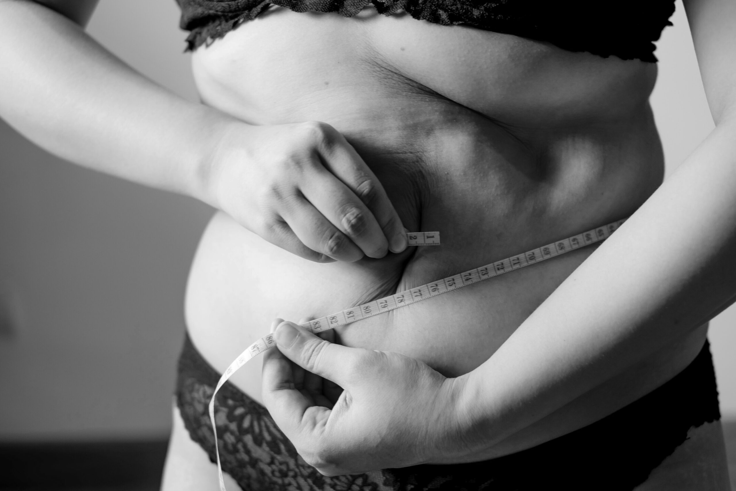Medical weight loss at Aeterna Luxe
